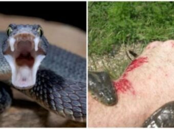 Σώζει ζωές! Αυτά πρέπει να κάνετε αν σας δαγκώσει φίδι! – Ομορφιά & Υγεία