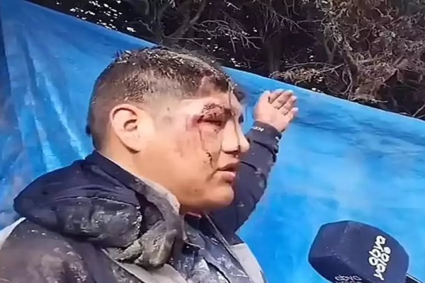 Φρικιαστικό περιστατικό στη Βολιβία: Τον έθαψαν ζωντανό για να τον προσφέρουν ως θυσία στη «Μητέρα Γη» (video) – Κόσμος
