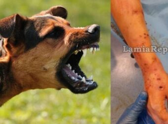 Τpόμος στην Λαμία: Άγpια επίθεση σκύλοu σε 35χρονη – Μήνuση στον ιδιοκτήτη του ζώου θα υποβάλλει το θύμα
