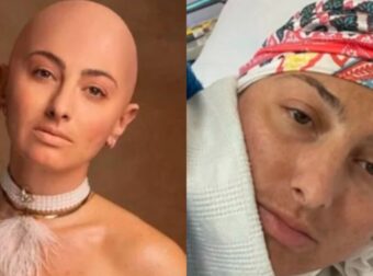 Με θάρρος & περηφάνεια: Η Ρεγγίνα Μακέδου βγάζει το τουρμπάνι και στέλνει δυνατό μήνυμα κατά του καρκίνου