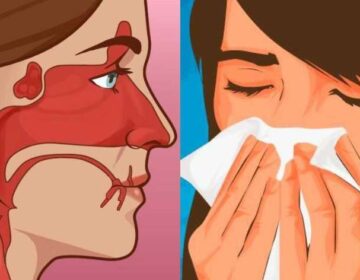 Βουλωμένη μύτη κάθε πρωί: 8 αιτίες που δεν είχατε φανταστεί και τι να κάνετε για να αναπνεύσετε ελεύθερα