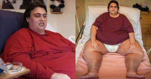 Ζύγιζε 412 κιλά στα 25 του: Νεκpός ο «παχύτερος άντρας της χώρας», σε ηλικία 34 ετών, τον μετέφεραν με γερανό