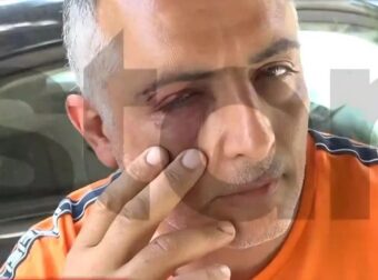 Άγριος ξυλοδαρμός ελεγκτή εισιτηρίων σε λεωφορείο – «Με δάγκωσαν, με χτυπούσαν στο κεφάλι»