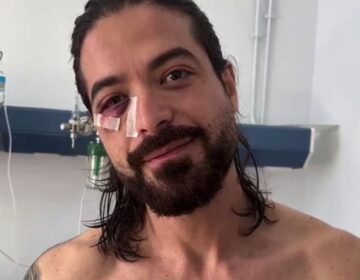 Έσπασε τη σιωπή του ο Άρης Μουγκοπέτρος για το ατύχημα με την κροτίδα που του στέρησε τα 2 δάκτυλα του – «Νόμιζα ότι…»