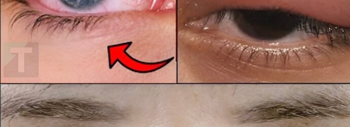 Αν έχετε κάποιο από αυτά τα σημάδια, συμβουλευτείτε αμέσως έναν γιατρό πριν να είναι πολύ αργά