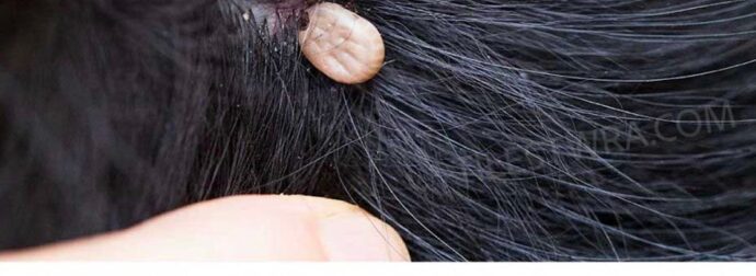 Μόλις ανακάλυψα αυτό στα μαλλιά του γιου μου. Τι είναι αυτό; Δεν είμαι σίγουρη αν πρέπει να πάμε στο γιατρό