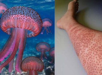 «Καμπανάκι» για μωβ μέδουσες σε θάλασσες στην Ελλάδα – Οι περιοχές που είναι στο «κόκκινο»