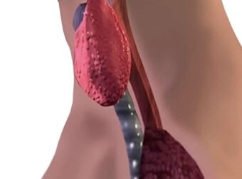 6 τύποι τροφών που επηρεάζουν αρνητικά τον θυρεοειδή σας