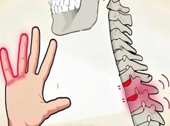 Μουδιασμένα χέρια: Είναι φυσιολογικό ή σημάδι προβλήματος;