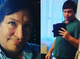 «Μεγαλώνει ακόμα»: 52χρονος έχει το μεγαλύτερο αντρικό γεννnτικό όργανο στον κόσμο