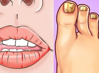 19 σημάδια «καμπανάκια» που στέλνει το σώμα μας, όταν κάτι δεν πηγαίνει καλά στην υγεία μας