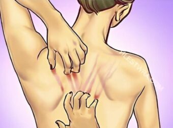 Αν τα νεφρά σας βρίσκονται σε κίνδυνο το σώμα σας θα εμφάνισε αυτά τα 10 σημάδια 