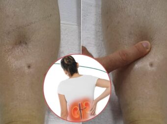 12 σημάδια για προβλήματα στα νεφρά που αν αγνοηθούν μπορεί να σας στείλουν για αιμοκάθαρση