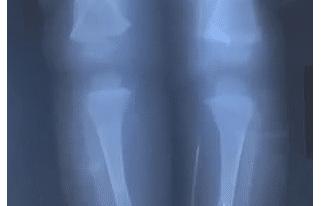 Σοκ Τρυπούσε με βελόνες το κορμί του μωρού της για τον αδιανόητο λόγο