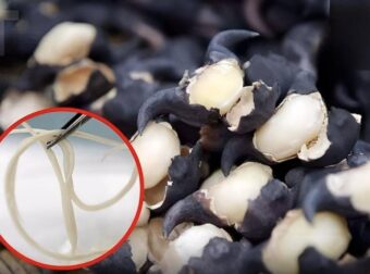 5 λαχανικά που δεν πρέπει ποτέ να τρώτε ωμά — μπορεί να κρύβουν φωλιές σκουληκιών που μετατρέπονται σε παράσιτα στο στομάχι σας