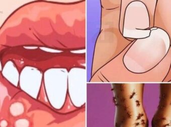 10 τρόποι με τους οποίους το σώμα σας μπορεί να σας προειδοποιεί ότι κάτι δεν πάει καλά