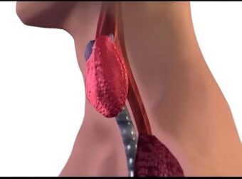 Σταματήστε να τρώτε αμέσως αυτά τα 6 τρόφιμα που χειροτερεύουν τον θυρεοειδή