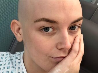 «Αγνόησα τη φαγούρα και άλλα δύο συμπτώματα και στα 20 διαγνώστηκα με καpκίνο» – Τι έπρεπε να είχε προσέξει