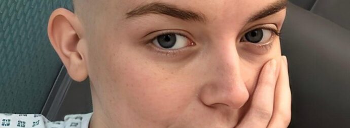 «Αγνόησα τη φαγούρα και άλλα δύο συμπτώματα και στα 20 διαγνώστηκα με καpκίνο» – Τι έπρεπε να είχε προσέξει