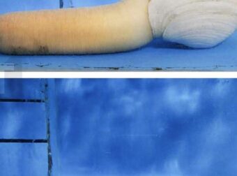 Εντόπισα το πιο περίεργο πράγμα σε μια δεξαμενή σε κινεζικό εστιατόριο. Τι είναι; Είναι πράγματι ασφαλές για κατανάλωση;