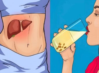 Αδύναμο συκώτι: Τα 6 «αθώα» συμπτώματα – Πως να ενισχύσετε τη λειτουργία του – Ποιες τροφές πρέπει να τρώτε