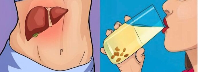 Αδύναμο συκώτι: Τα 6 «αθώα» συμπτώματα – Πως να ενισχύσετε τη λειτουργία του – Ποιες τροφές πρέπει να τρώτε