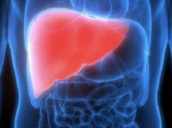 Κινδυνεύει το συκώτι σας; 12 πρώιμα σημάδια κίρρωσης του ήπατος που δεν πρέπει να αγνοήσετε