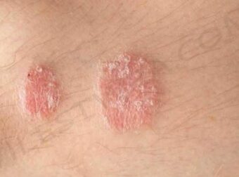 Εάν παρατηρήσετε αυτά τα σημάδια στο σώμα σας, συμβουλευτείτε αμέσως έναν γιατρό