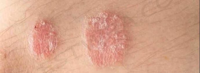 Εάν παρατηρήσετε αυτά τα σημάδια στο σώμα σας, συμβουλευτείτε αμέσως έναν γιατρό