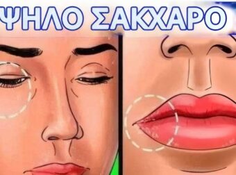 12 σημάδια ότι το σάκχαρό σας είναι πολύ υψηλό