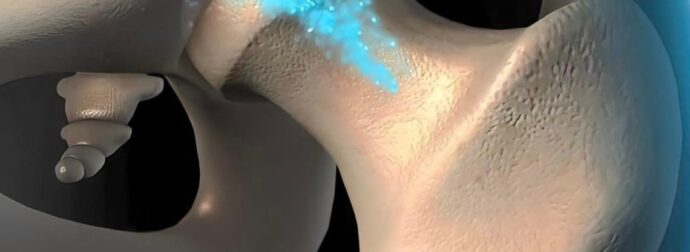 Το φρούτο που προλαμβάνει την οστεοπόρωση – Ποια είναι η ιδανική ποσότητα