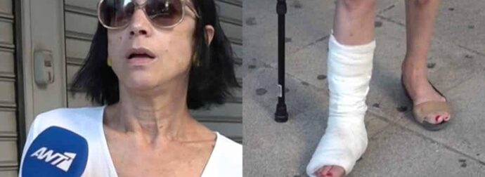 Ατύχημα για την Έλενα Τοπαλίδου: Με γύψο και μπαστούνι στα χέρια