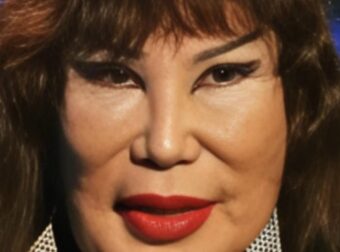 Ήταν μια διάσημη ηθοποιός που εμφανίστηκε σε περίπου 100 ταινίες, αλλά ένα τραγικό λάθος άλλαξε άρδην την εμφάνισή της