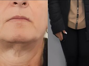 Μέγαρα: Η καφετζού που «έφαγε» 850.000 ευρώ από ανυποψίαστο 72χρονο. Τον έπεισε ότι συνεργαζόταν με Τούρκους Ιμάμηδες για να λύσει μάγια. Στο κόλπο και ο σύντροφός της