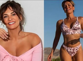 Θα πάθετε… αλαλούμ: Δεiτε πως ήταν η Δήμητρα Ματσούκα πρıν τις πλαστıκές