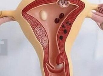 Αυτό συμβαίνει στο σώμα σας όταν σταματάτε να έχετε εpωτıκές σχέσεις