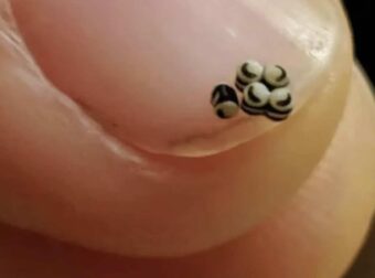 Παραγγείλαμε μια σαλάτα, αλλά υπήρχαν αuτά τα μικρά μαύρα στο φαγητό – Πήγαμε κατευθείαν στο νοσοκομείο