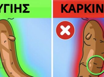 Τι αποκαλύπτει το χρώμα των κοπράνων σας για την υγεία σας