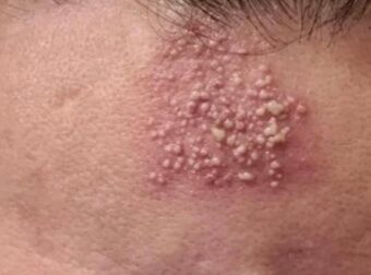 Αυτές είναι οι συνέπειες του να κοιμάσαι με…