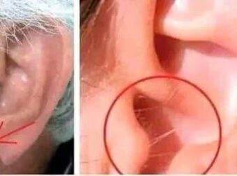 Να γιατί μεγαλώνουν τρίχες στα αυτιά σας
