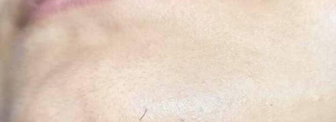 Αν είστε γυναίκα με γένια στο σαγόνι να τι σημαίνει για εσάς