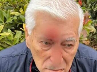 82χρονος δέχτηκε επίθεση από γιατρό «μποξέρ» – «Μου είπε ότι του χτύπησα το αμάξι και μου έδωσε 2 μπουνιές»