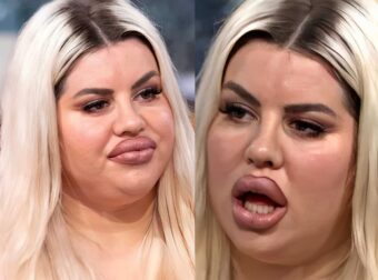 «Ξόδεψα 150.000 σε πλαστικές επεμβάσεις, αλλά δεν βρίσκω σύντροφο γιατί τρομάζω τους άντρες»