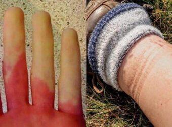 Ανακοπή καρδιάς: Τι θα νιώσετε μέρες πριν σας συμβεί – 6 συμπτώματα που πρέπει να αναγνωρίσετε εγκαίρως