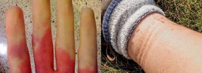 Ανακοπή καρδιάς: Τι θα νιώσετε μέρες πριν σας συμβεί – 6 συμπτώματα που πρέπει να αναγνωρίσετε εγκαίρως