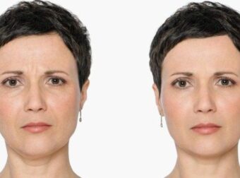 Κλιμακτήριος: 11 συμβουλές των ειδικών για να διατηρήσετε τη νεότητά σας κατά τη διάρκεια της εμμηνόπαυσης