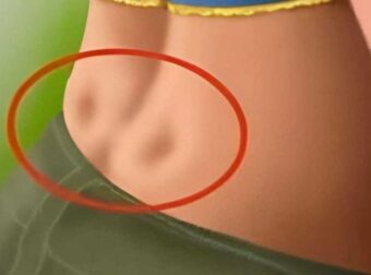 Έχετε δύο λακκάκια στο κάτω μέρος της πλάτης σας; Δείτε τι σημαίνει