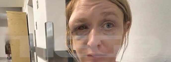 Κορωπί: «Έχουμε σχέση αγάπης με τον σύντροφό μου» λέει η 40χρονη που ξυλοκοπήθηκε – Συγκλονίζει η εικόνα της μετά την κακοποίηση