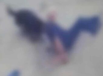 H στιγμή που Ροτβάιλερ κατασπαράζει τον ιδιοκτήτη του στη Καλαμάτα – Σκληρές εικόνες