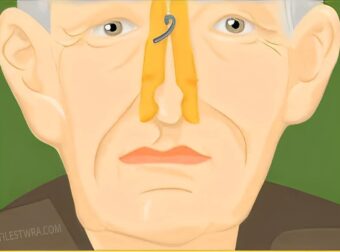 Να γιατί υπάρχει η λεγόμενη «γεροντίλα» και πως αντιμετωπίζεται